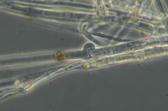 Sclerotiumrolfsii