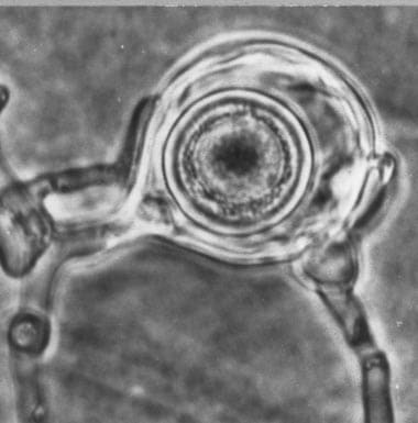 Aphanomyces
