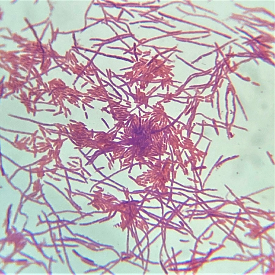 Pseudomonas(genera)