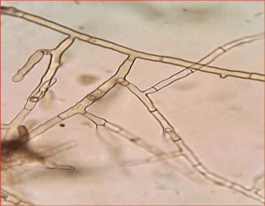 Rhizoctoniasolani